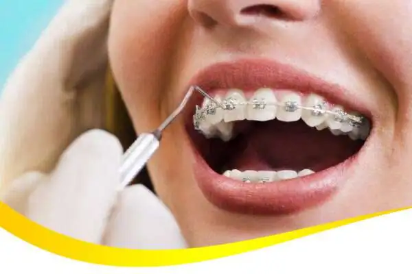 control ortho