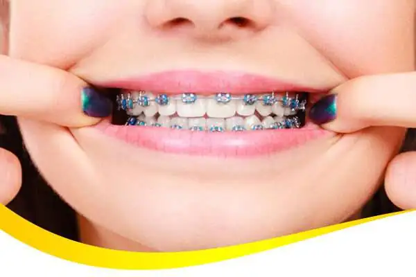 orthodontik