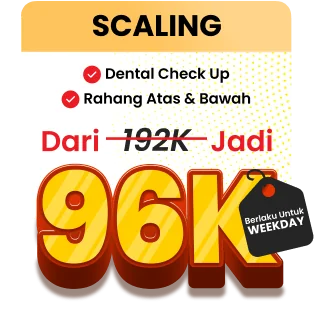 Promo Scaling, Promo Tambal Gigi Belakang, Klinik Gigi Terdekat