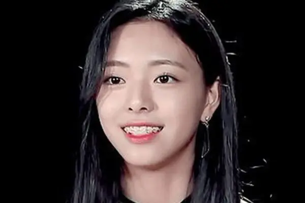 Dafar Idol Kpop Yang Menggunakan Behel Gigi, Perawatan Gigi Idol Kpop, Gigi Putih Seperti Artis Kpop