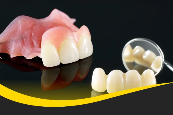 gigi tiruan sebagian