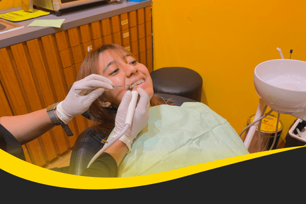 scaling gigi teman dental tangerang