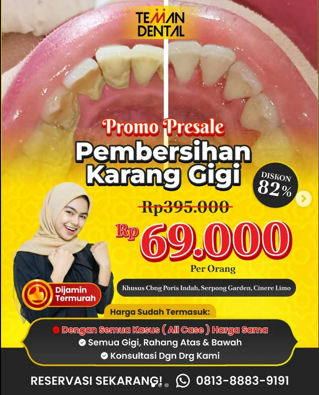 RESERVASI