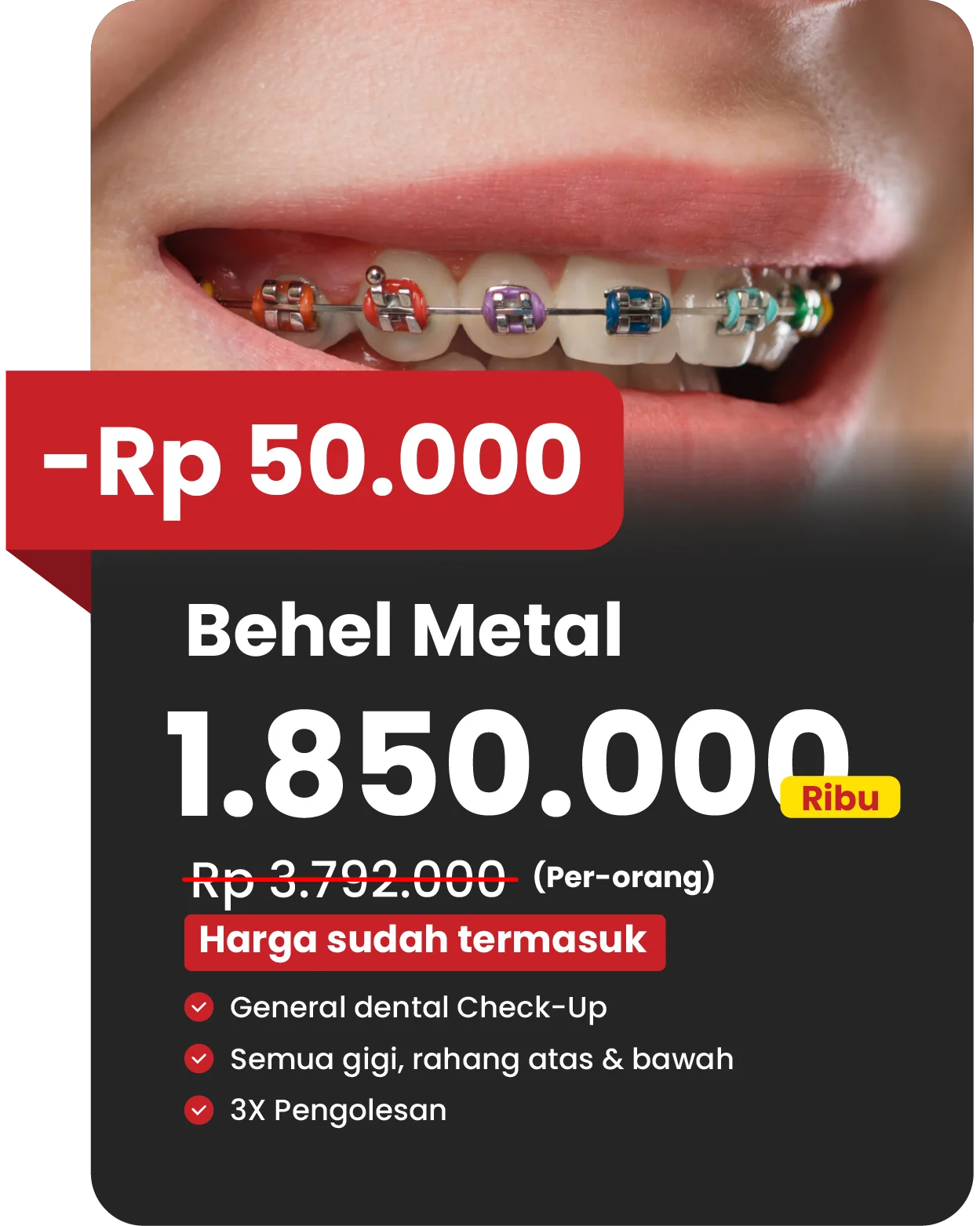 Potongan harga pasang behel warna 50rb via website teman dental