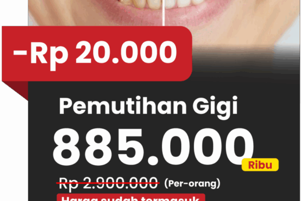 Potongan harga 20rb bleaching via website klinik gigi teman dental