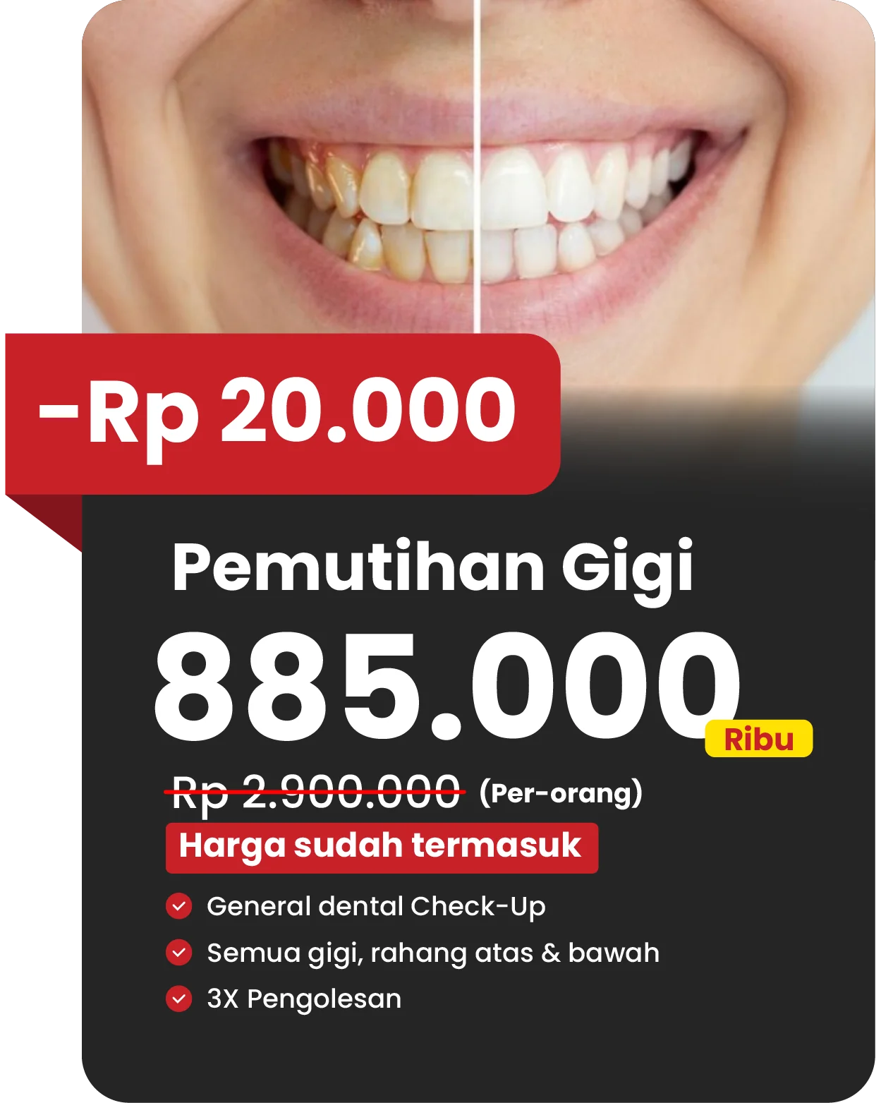 Potongan harga 20rb bleaching via website klinik gigi teman dental
