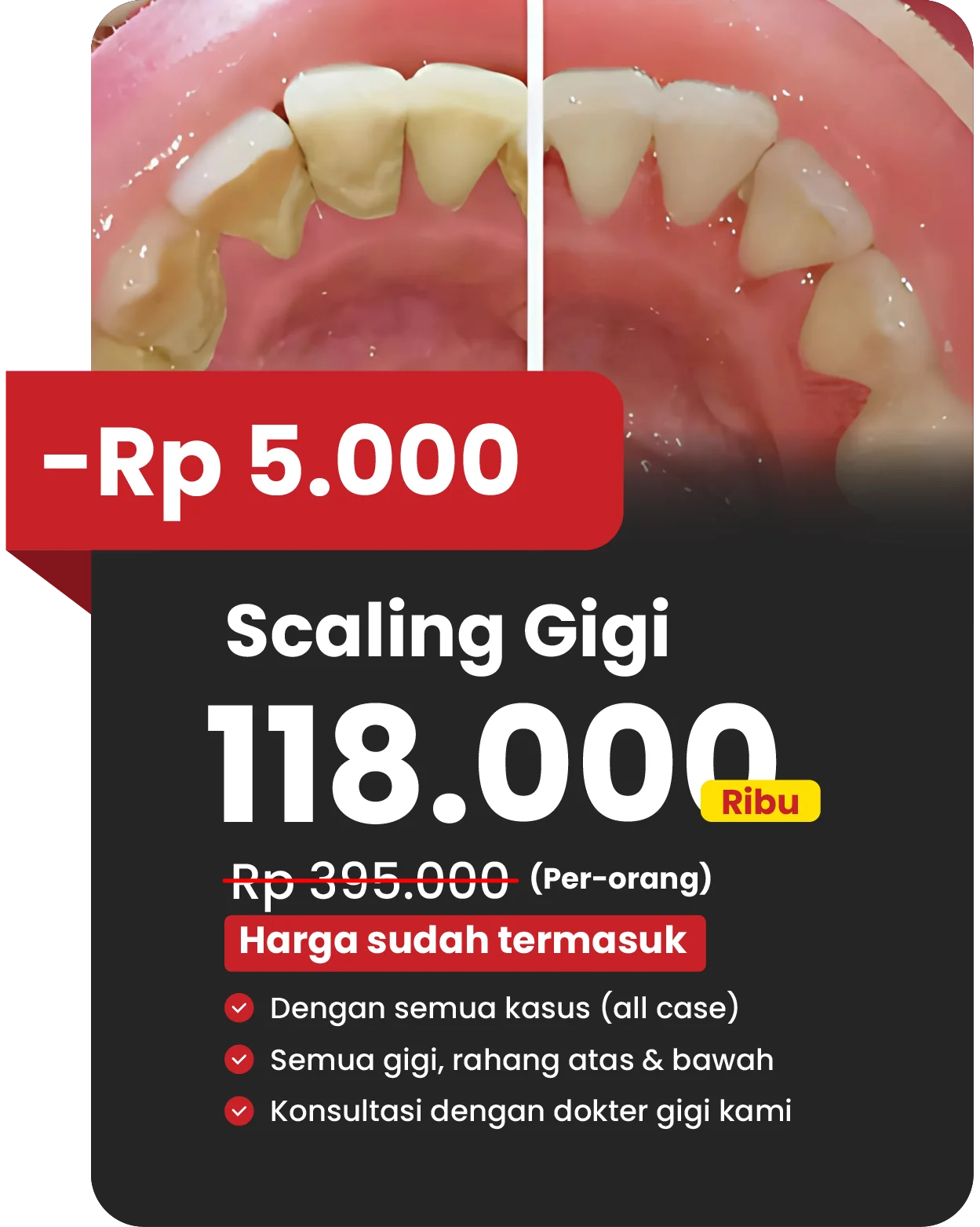 Promo scaling di website klinik gigi teman dental ada potongan 5rb