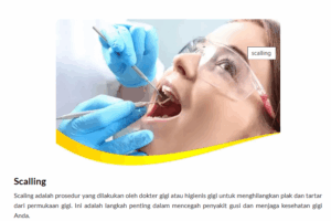 Pembersihan Karang Gigi Ciputat