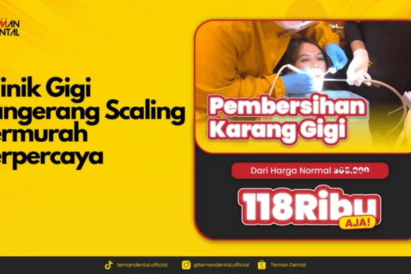 Klinik Gigi Tangerang Scaling Termurah Terpercaya