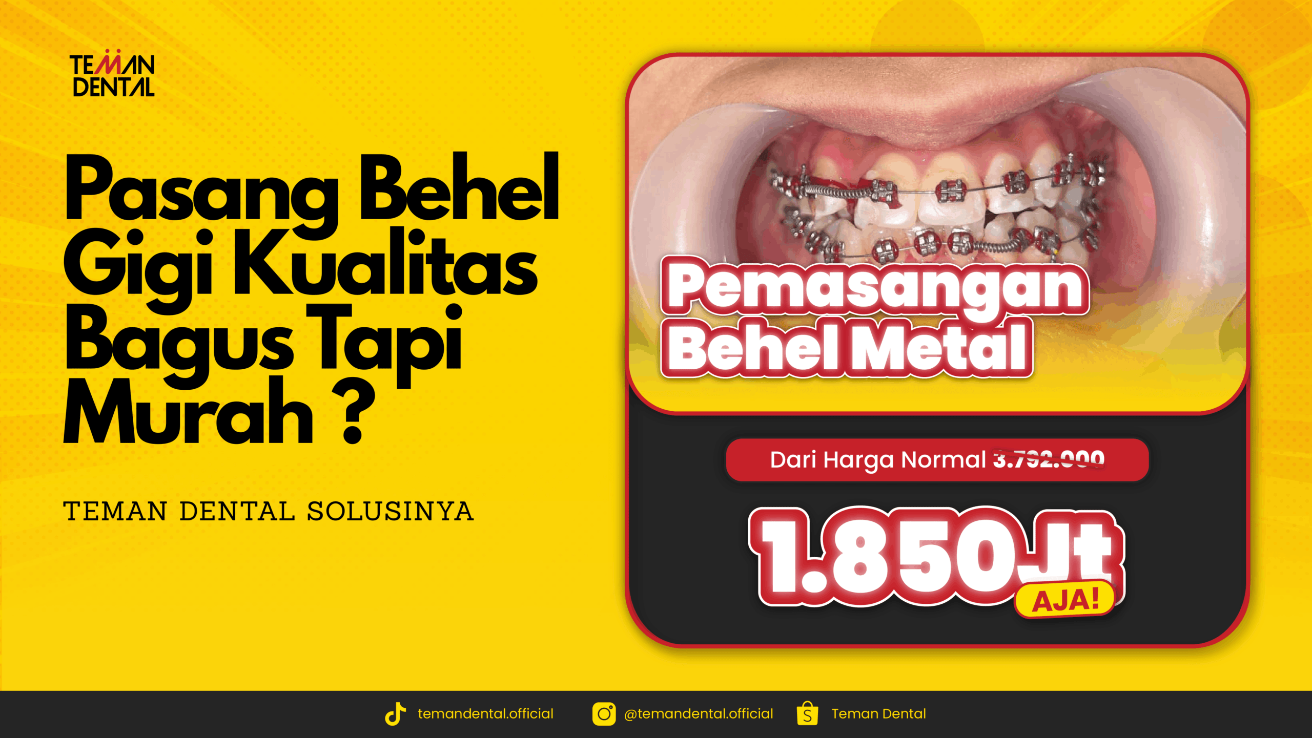 Pasang Behel Gigi Kualitas Bagus Tapi Murah ? Teman Dental Solusinya