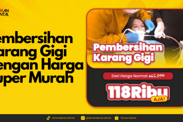 Klinik Gigi | Pembersihan Karang Gigi Dengan Harga Super Murah