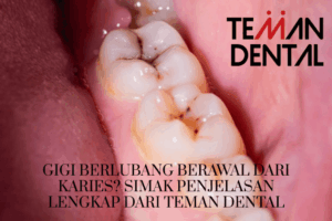 Gigi Berlubang Berawal dari Karies Simak Penjelasan Lengkap dari Teman Dental