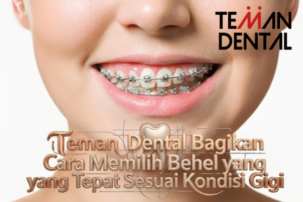 Teman Dental Bagikan Cara Memilih Behel yang Tepat Sesuai Kondisi Gigi