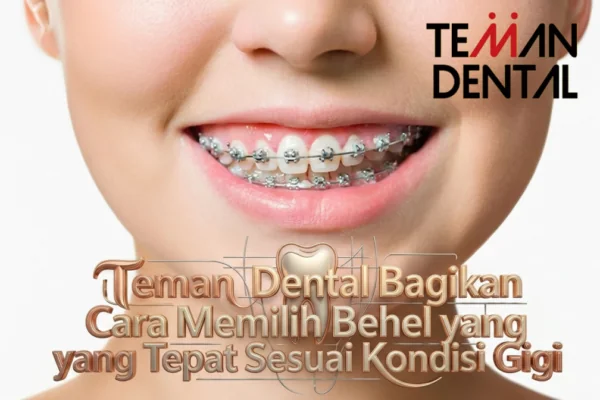 Teman Dental Bagikan Cara Memilih Behel yang Tepat Sesuai Kondisi Gigi