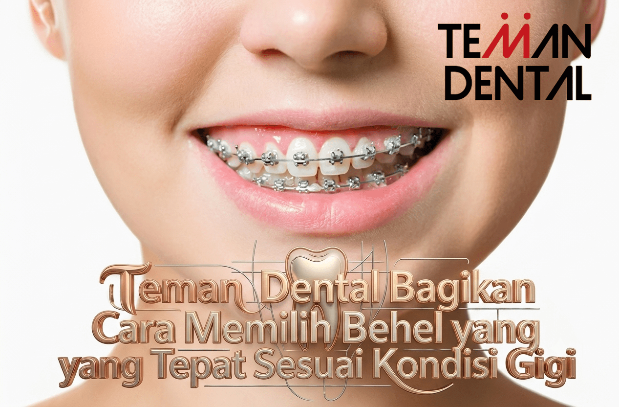 Teman Dental Bagikan Cara Memilih Behel yang Tepat Sesuai Kondisi Gigi