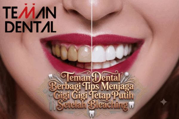 Teman Dental Berbagi Tips Menjaga Gigi Tetap Putih Setelah Bleaching