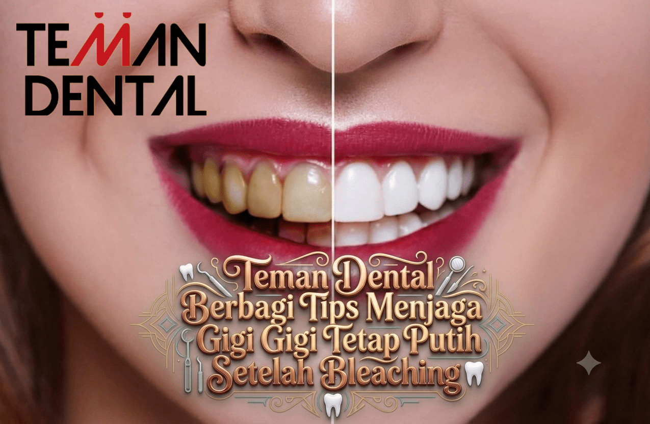 Teman Dental Berbagi Tips Menjaga Gigi Tetap Putih Setelah Bleaching