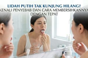 Lidah Putih Tak Kunjung Hilang Kenali Penyebab dan Cara Membersihkannya dengan Tepat