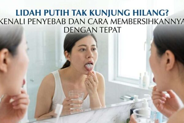 Lidah Putih Tak Kunjung Hilang Kenali Penyebab dan Cara Membersihkannya dengan Tepat